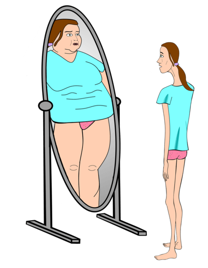 Анорексия: здравословно хранене при хранително разстройство
