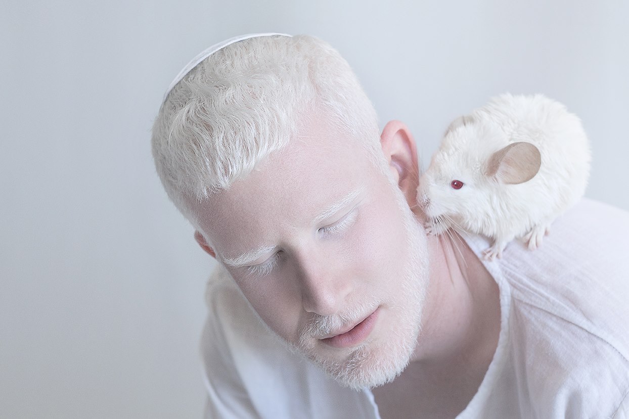 Хипнотизиращата красота на албиносите