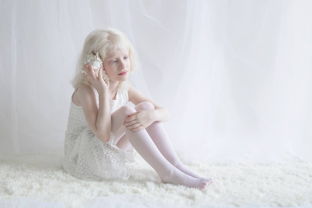 Хипнотизиращата красота на албиносите