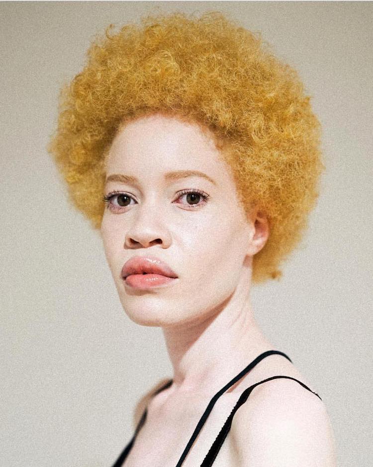 Руса афроамериканка с бяла кожа разбива стандартите за красота