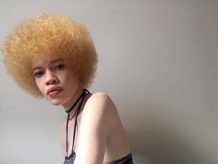 Руса афроамериканка с бяла кожа разбива стандартите за красота