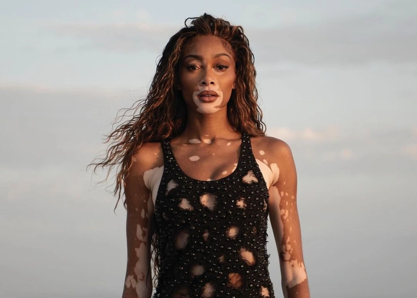 Жените трябва повече да се подкрепят