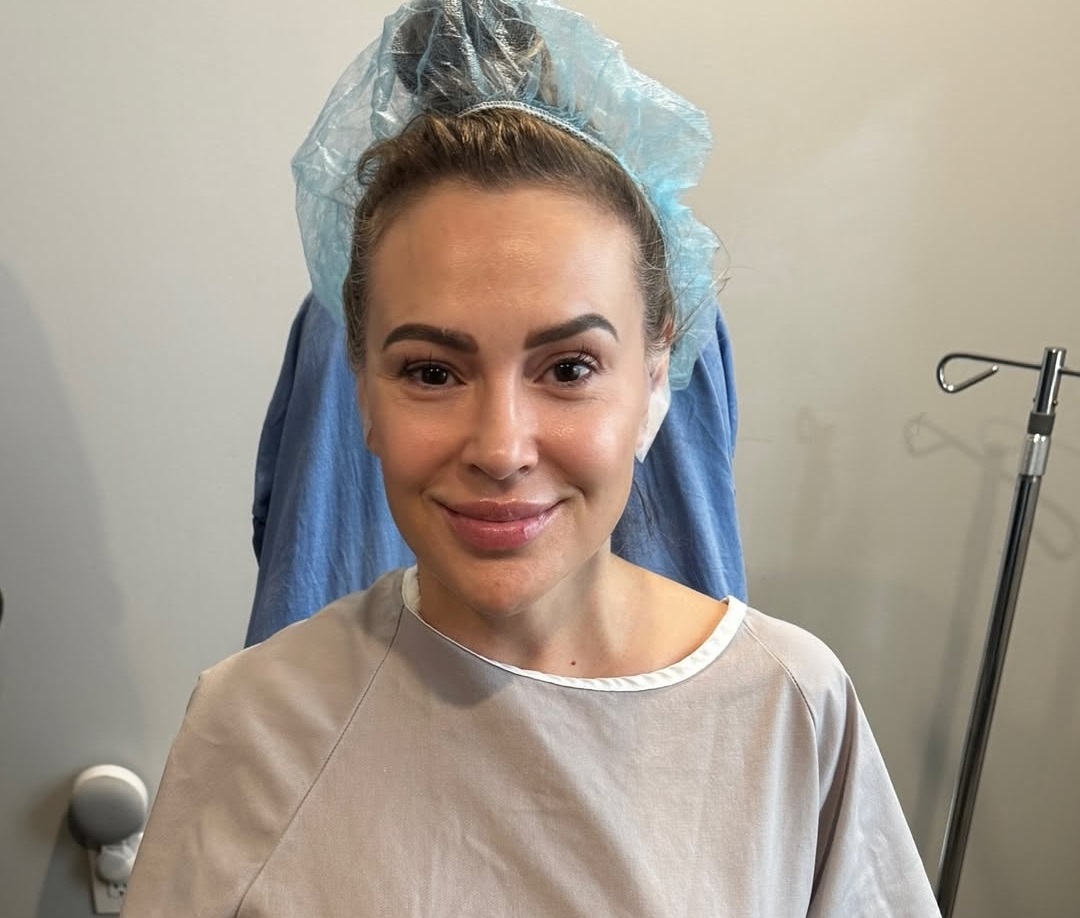 Едно смело решение: Защо Алиша Милано премахна гръдните си импланти и каква е истината за опасностите от силикона